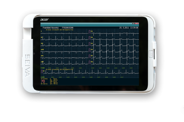 SEIVA CardioVision - Image 3